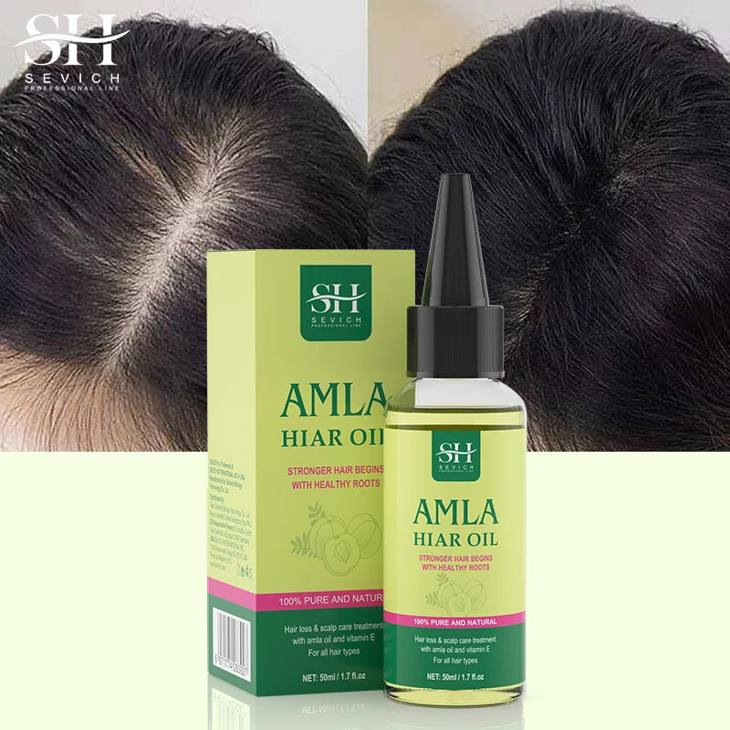 Pure India Amla Hair Growth Oil