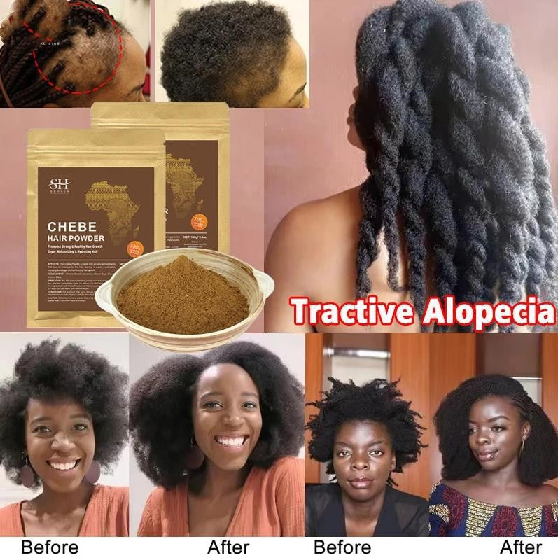 African Chebe Powder Hair Loss Treatment